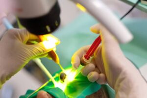 Leczenie pod mikroskopem. Endodoncja mikroskopowa.. Brzesko Bochnia