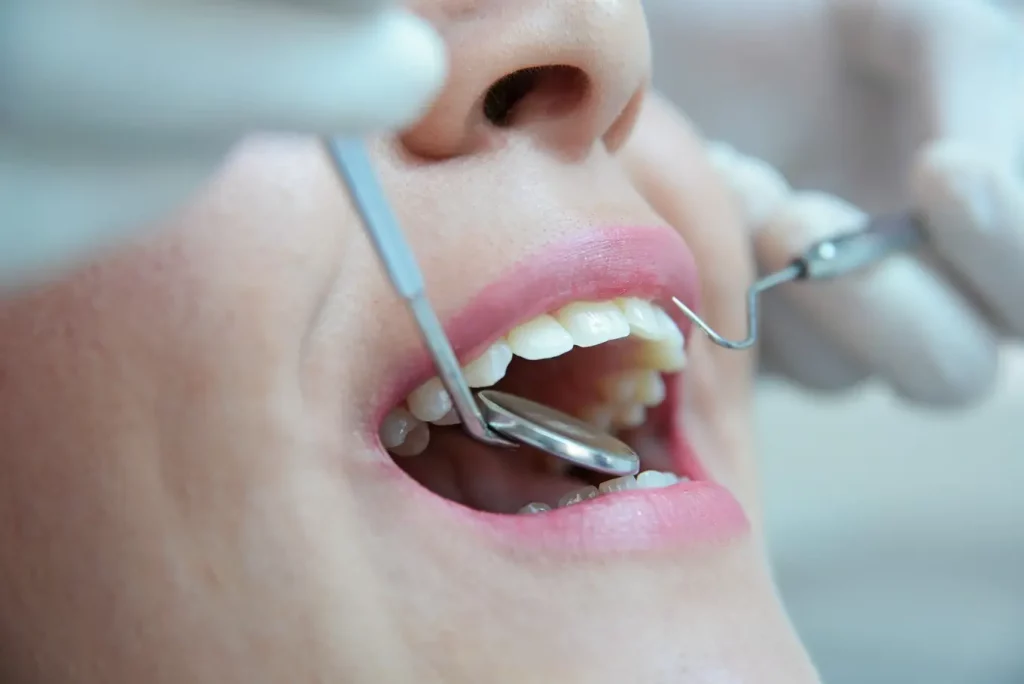 kontrola u dentysty