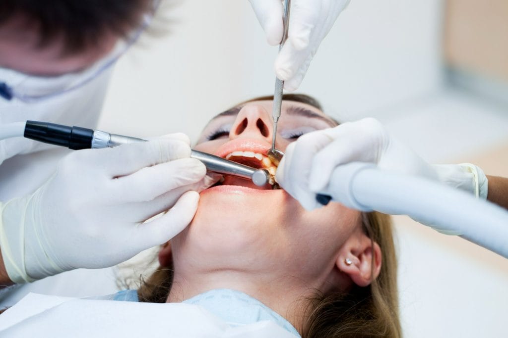 Mity i fakty na temat implantów zębowych